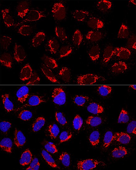 AP1M2 Antibody - BSA Free