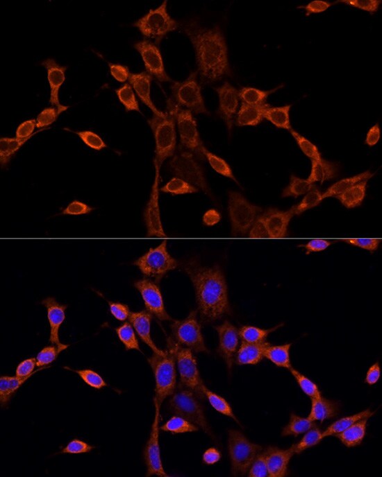 Dishevelled-1 Antibody - Azide and BSA Free