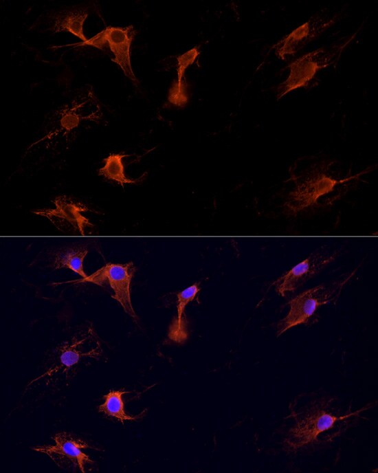Dishevelled-1 Antibody - Azide and BSA Free