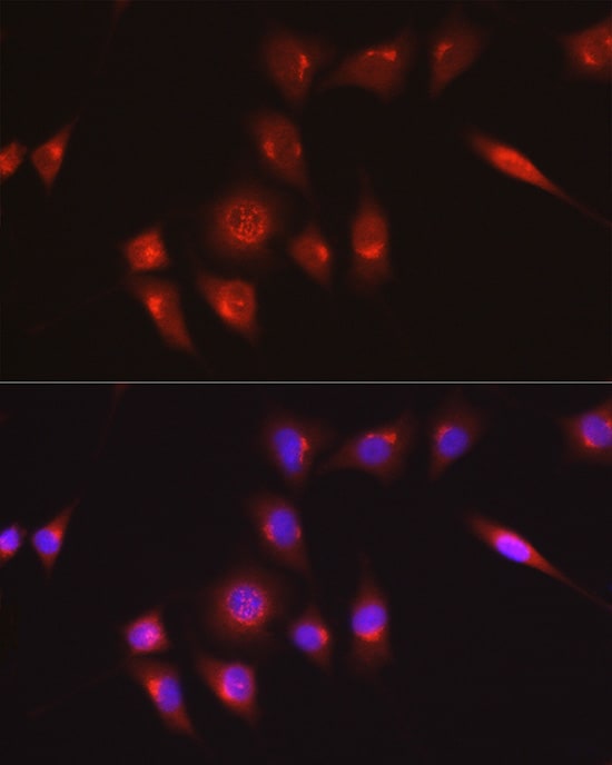 Collagen I alpha 1 Antibody - Azide and BSA Free
