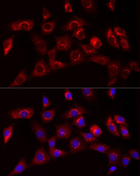 Collagen I alpha 1 Antibody - Azide and BSA Free