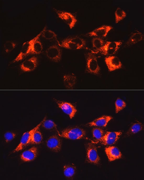 Collagen I alpha 1 Antibody - Azide and BSA Free