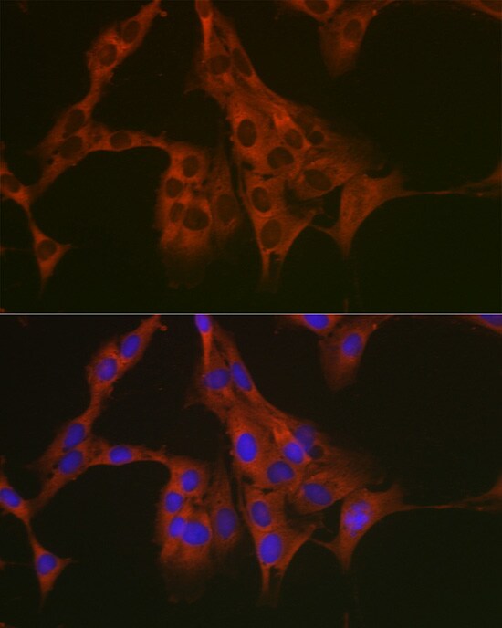 eEF1A1 Antibody - Azide and BSA Free