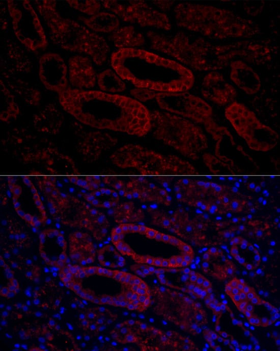 Aquaporin-3 Antibody - Azide and BSA Free