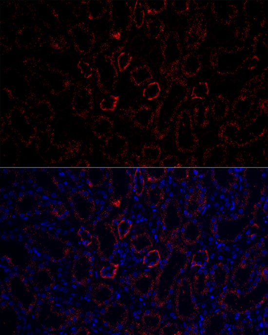 Aquaporin-3 Antibody - Azide and BSA Free