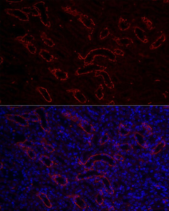 Aquaporin-3 Antibody - Azide and BSA Free