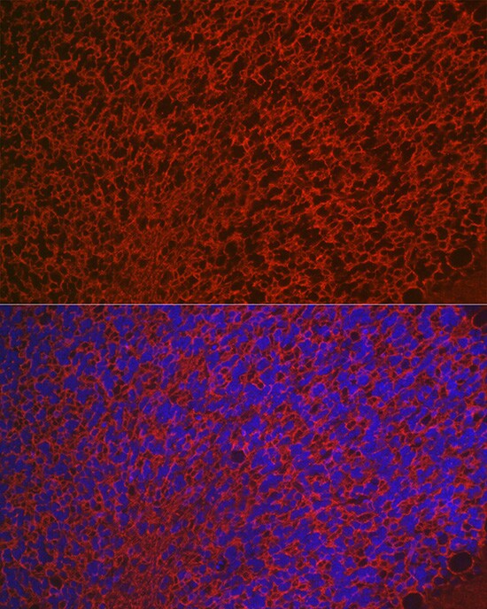Aquaporin-4 Antibody - Azide and BSA Free