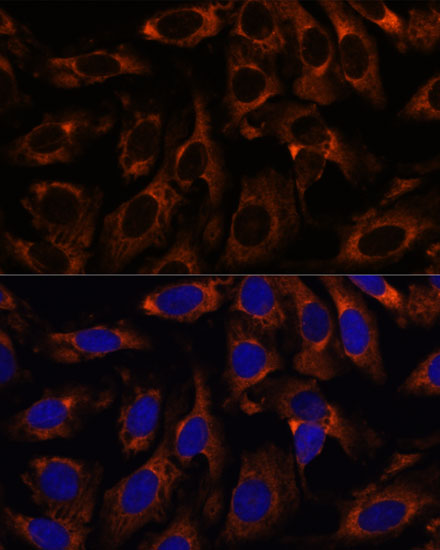 CCT3 Antibody - BSA Free