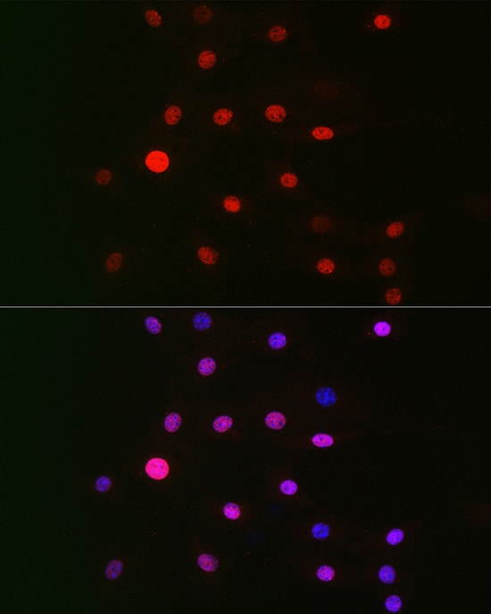 CSN1 Antibody - BSA Free