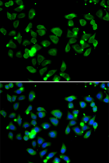 CARD11/CARMA1 Antibody - BSA Free