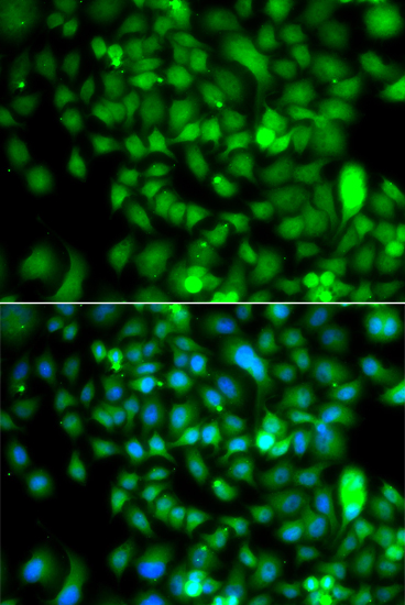 CSRP2BP Antibody - BSA Free