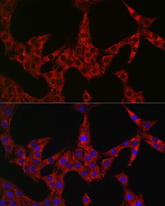 Dfna5 Antibody - Azide and BSA Free
