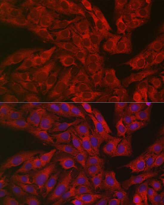 Dfna5 Antibody - Azide and BSA Free