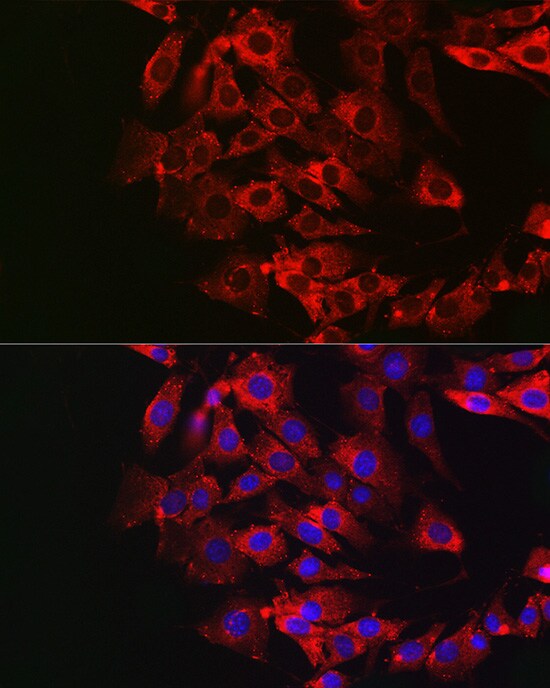 Dfna5 Antibody - Azide and BSA Free