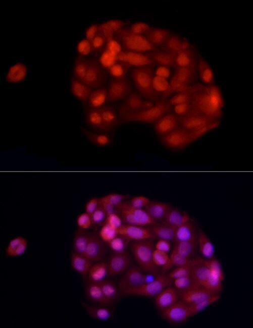 ADAR Antibody
