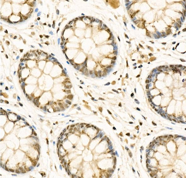 ADAR Antibody