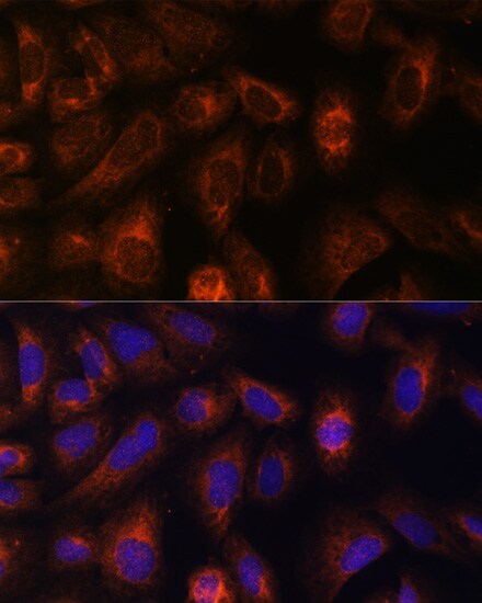 CAD Antibody - BSA Free