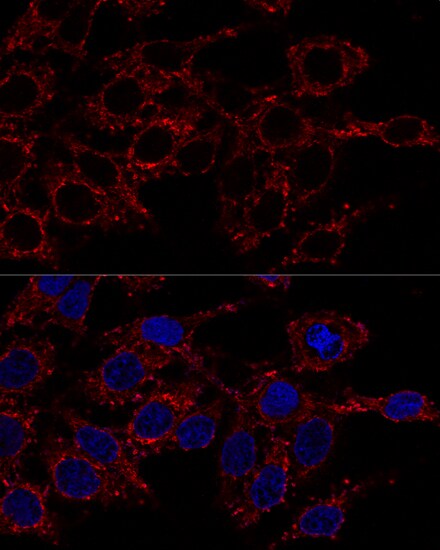 ATP5A Antibody - BSA Free
