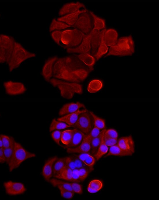 Cytokeratin 8 Antibody - Azide and BSA Free