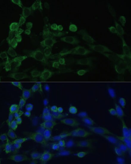 EEF1B2 Antibody - BSA Free