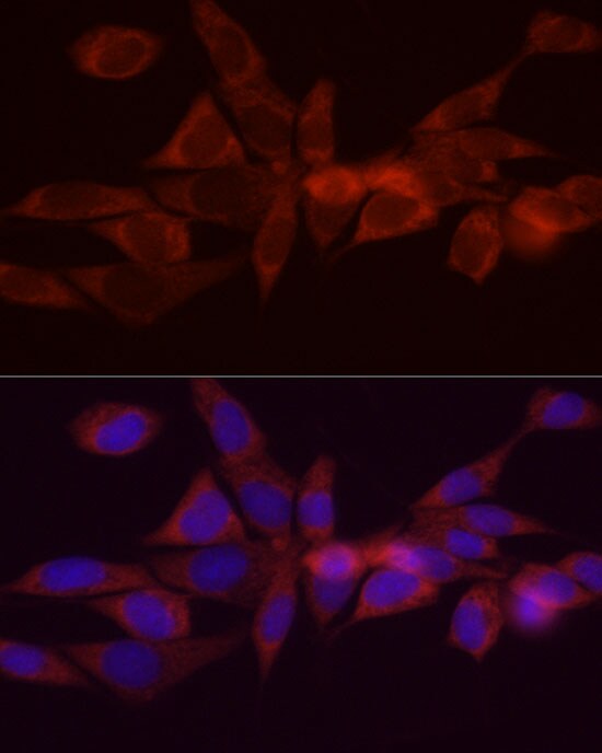 DGAT1 Antibody - BSA Free