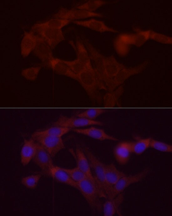 DGAT1 Antibody - BSA Free