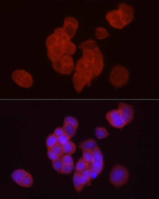 DGAT1 Antibody - BSA Free