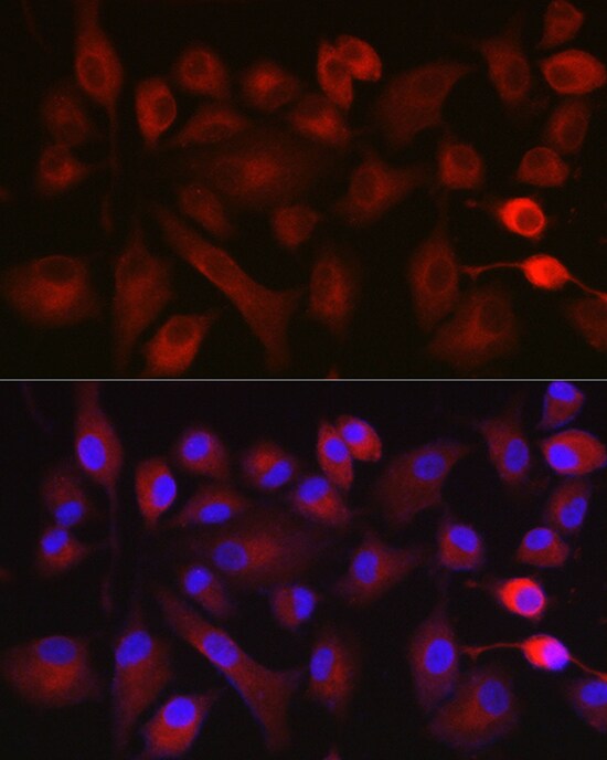 NOX5 Antibody - Azide and BSA Free