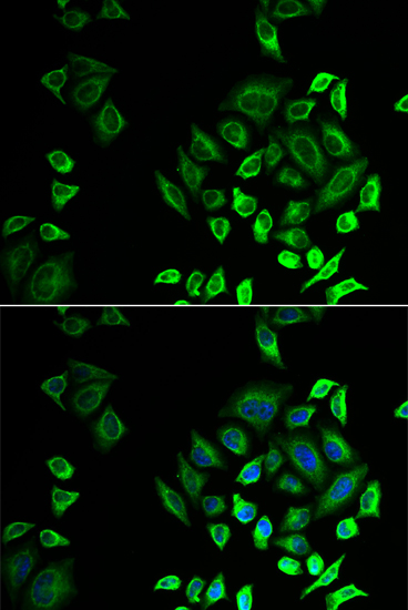 Phospholipase A2 IID Antibody - BSA Free