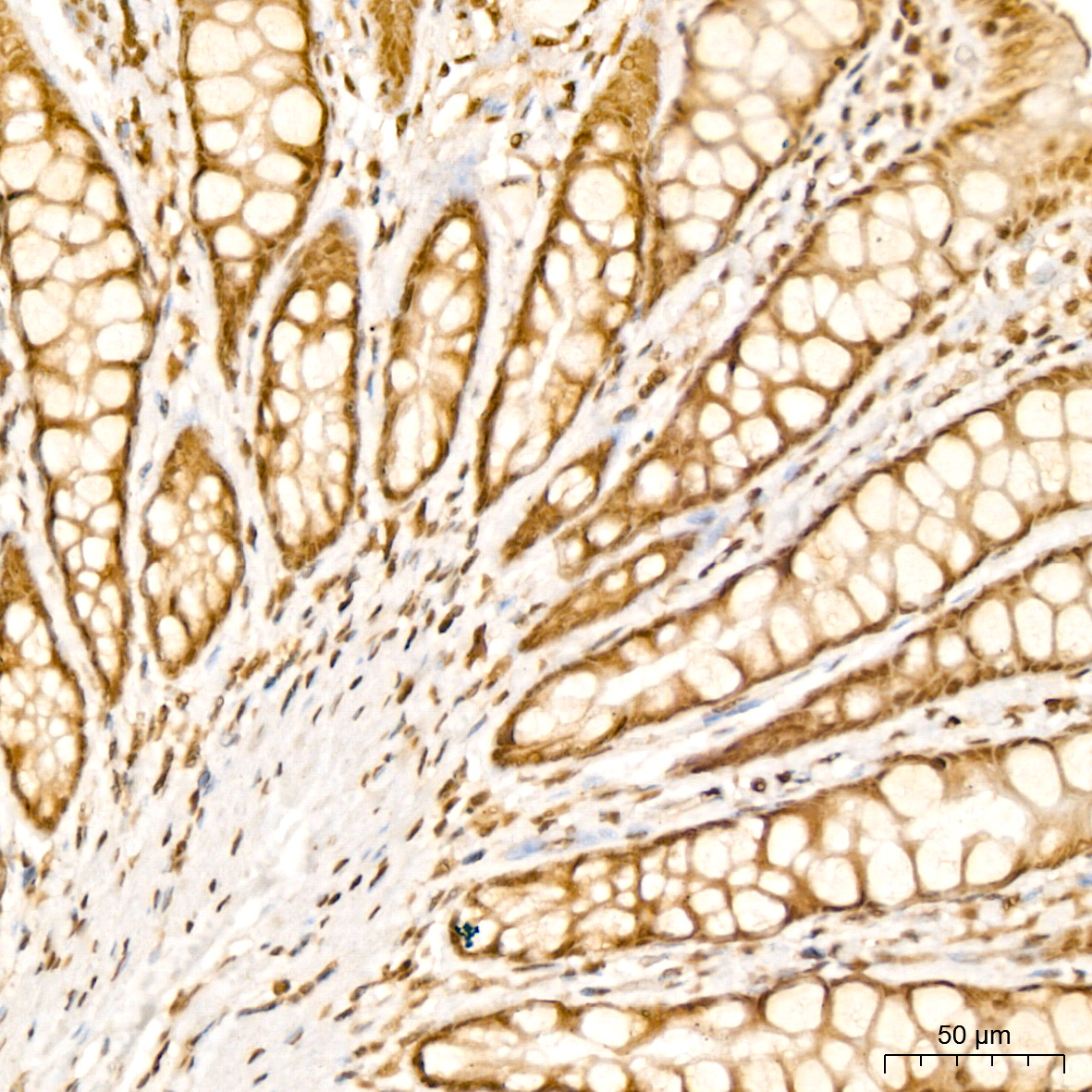 PARP3 Antibody - BSA Free