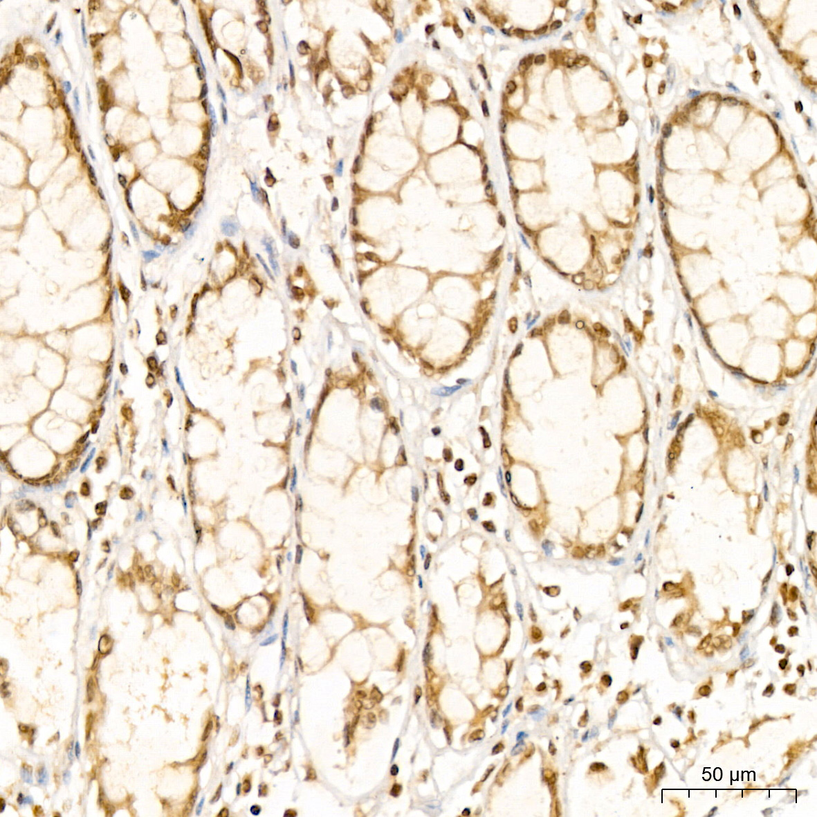 PARP3 Antibody - BSA Free