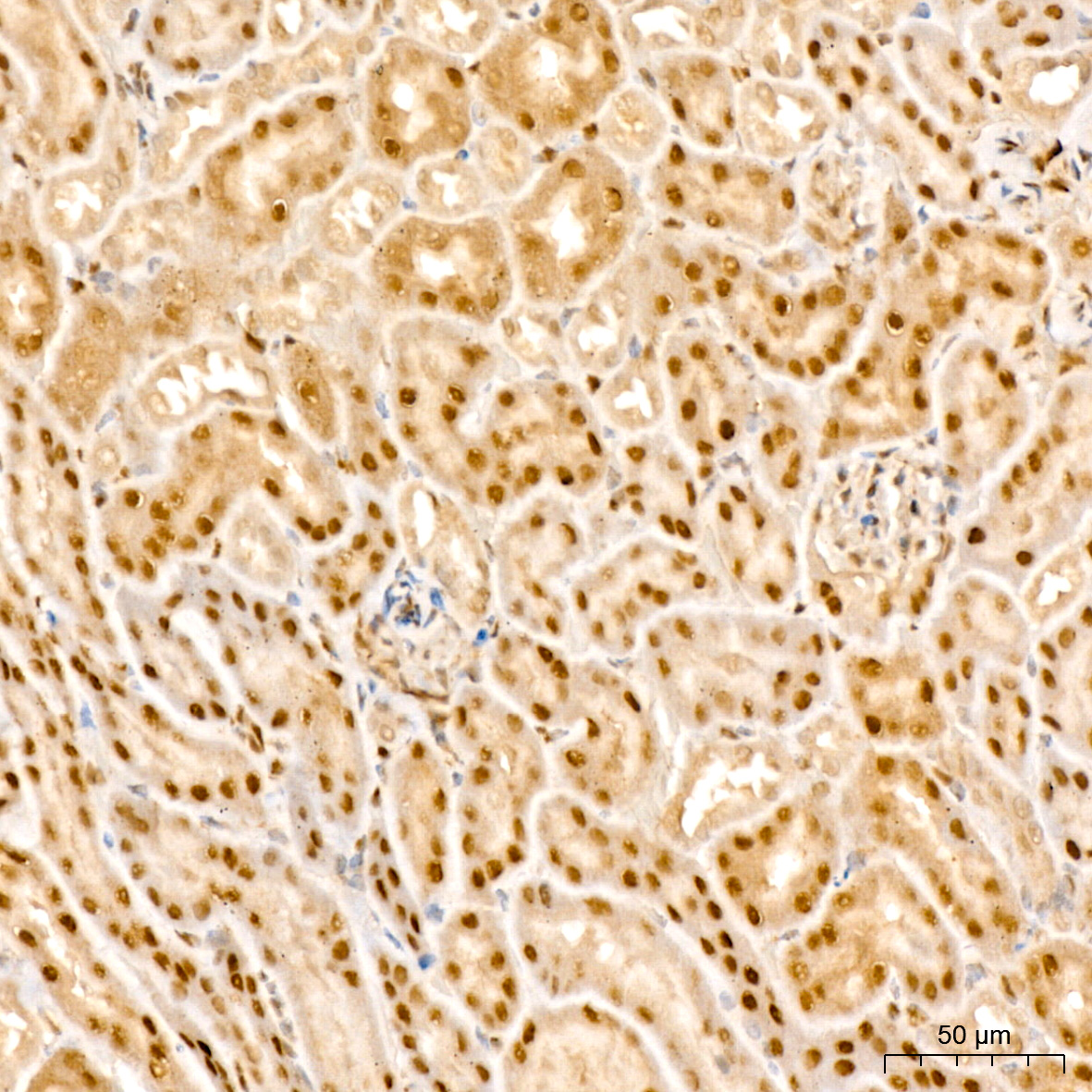 PARP3 Antibody - BSA Free