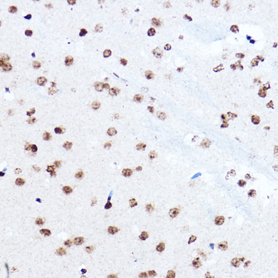 SETD5 Antibody - Azide and BSA Free