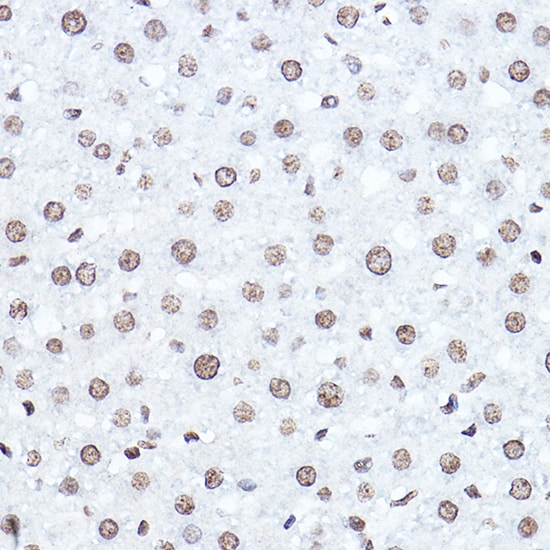 SETD5 Antibody - Azide and BSA Free
