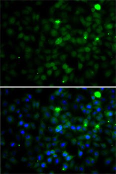 SMYD4 Antibody - BSA Free