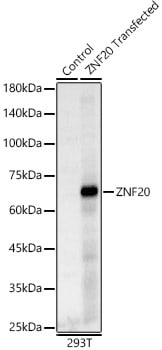 ZNF20 Antibody - BSA Free