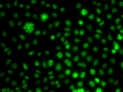 UBE2R2 Antibody - BSA Free