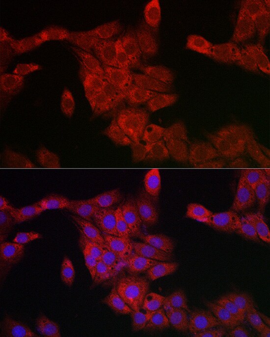 PDCD10 Antibody - Azide and BSA Free