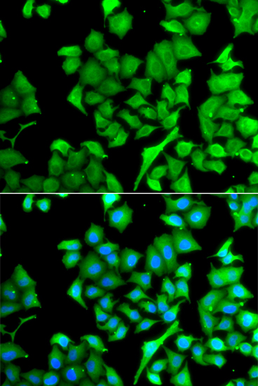 NAT13 Antibody - BSA Free