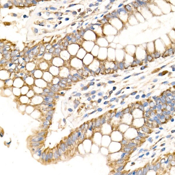 MT-CO2 Antibody - Azide and BSA Free