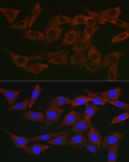 WNK3 Antibody - Azide and BSA Free