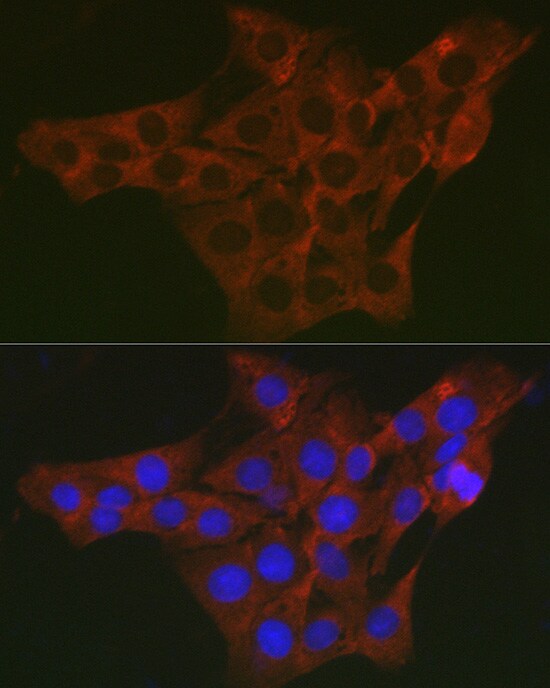 WNK3 Antibody - Azide and BSA Free