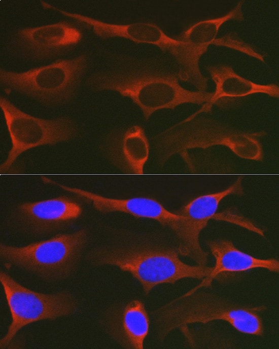 WNK3 Antibody - Azide and BSA Free