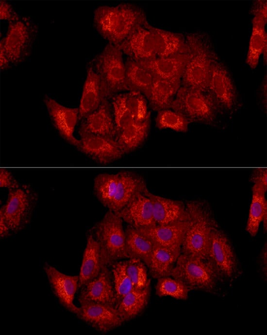 TIMM23 Antibody - Azide and BSA Free
