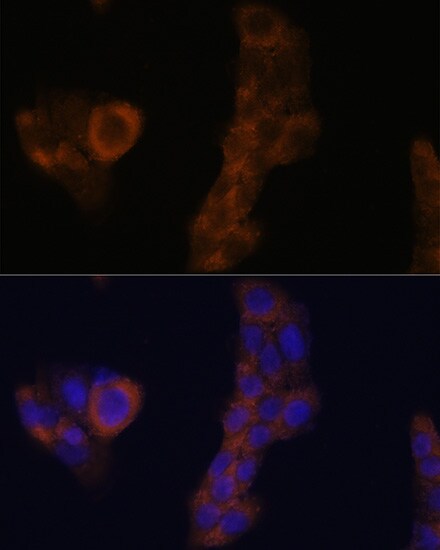 RPL23A Antibody - BSA Free