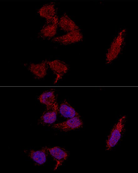 RPL23A Antibody - BSA Free