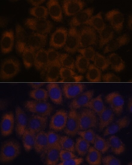 RPL23A Antibody - BSA Free