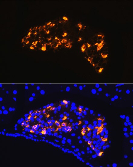 Somatostatin Antibody - Azide and BSA Free