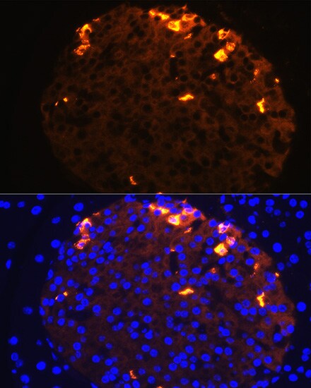Somatostatin Antibody - Azide and BSA Free