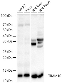 TIMM10 Antibody - BSA Free